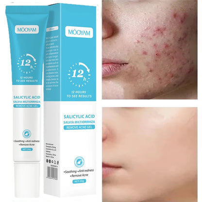 Clear Skin Renewal Acne Cream – Pore Refining, Oil Control & Spot Fading