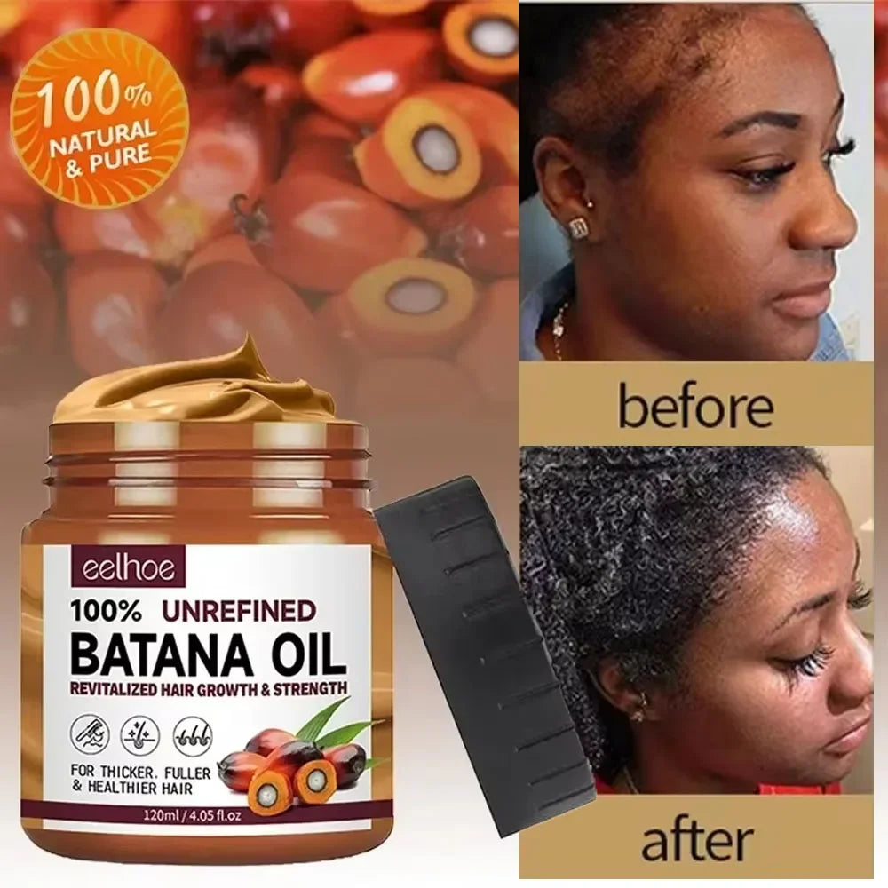 Batana Hair Growth Oil – Nourishing, Strengthening &amp; Anti-Hair Loss Treatment