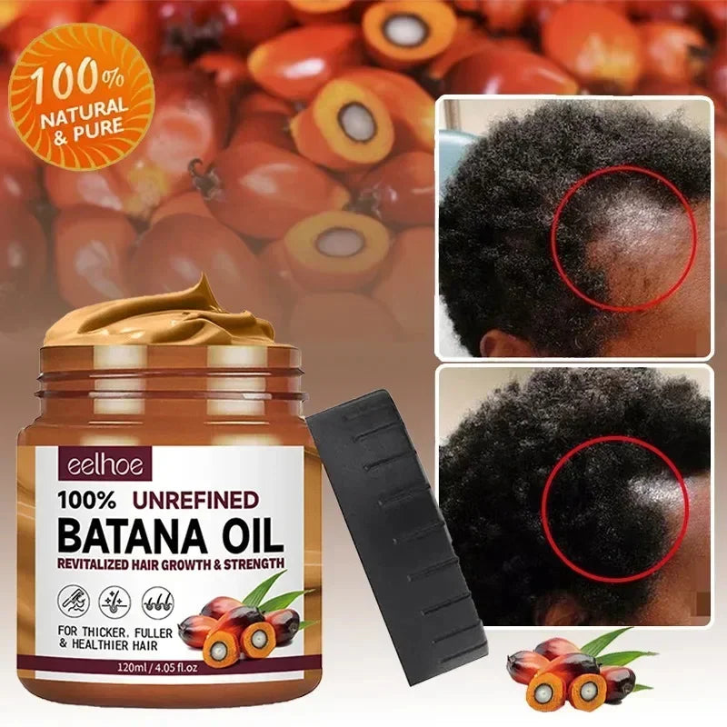 Batana Hair Growth Oil – Nourishing, Strengthening &amp; Anti-Hair Loss Treatment